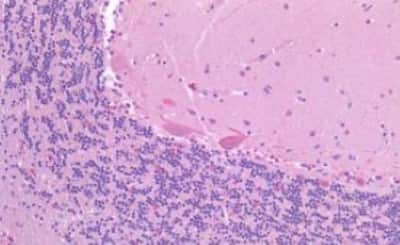 Immunohistochemistry-Paraffin: CSMD1 Antibody [NBP3-14295]